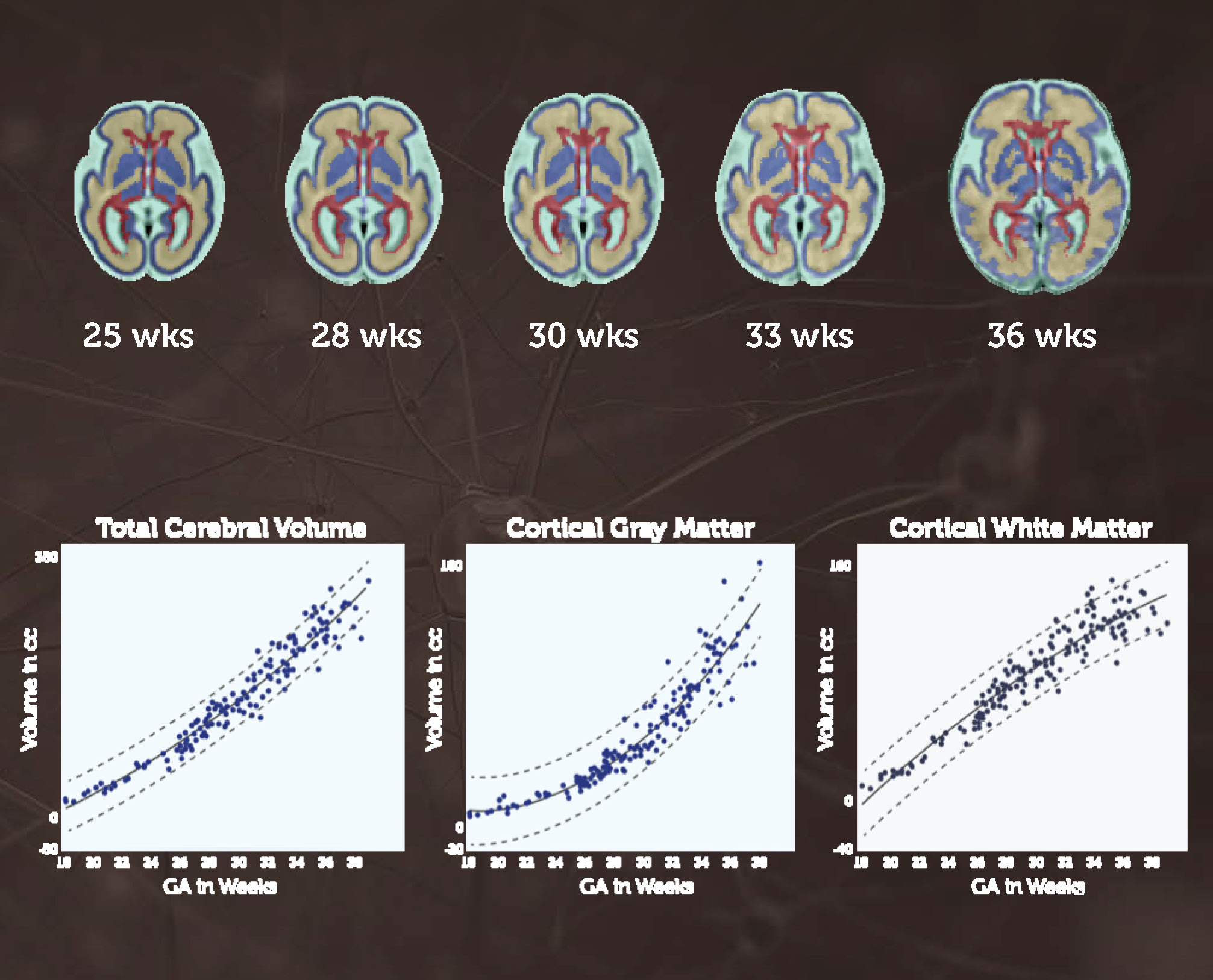Exploration of the developing brain - Children's National