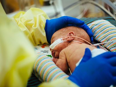 A sirtuin might help repair a common neonatal brain injury