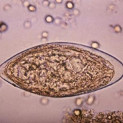 Schistosoma haematobium egg
