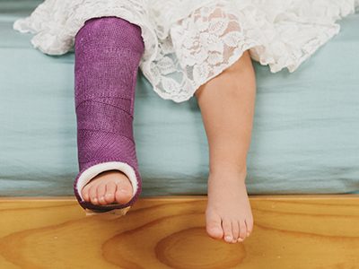 young girl sitting on a bed with a cast