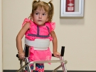 little girl with spina bifida