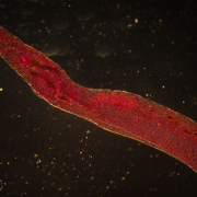 schistosome blood fluke