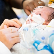 baby cardioilogy patient