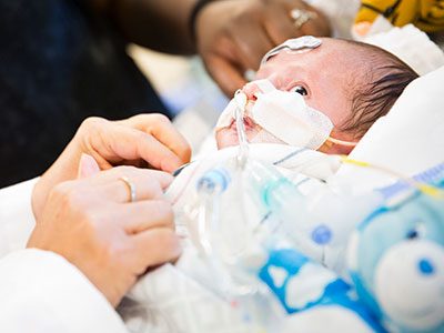 baby cardioilogy patient