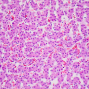 Hepatocytes