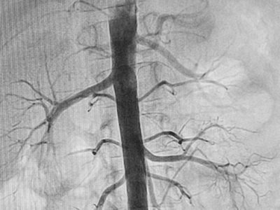 Pediatric angiography