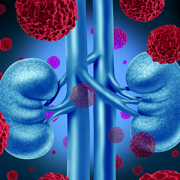 illustration of cancer cells attacking kidneys