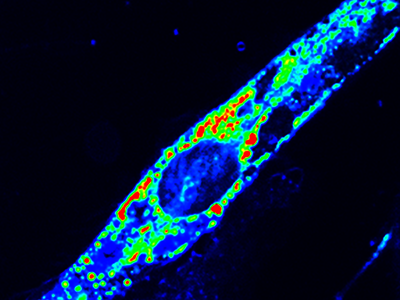 Injury triggered change in ER calcium of a muscle cell