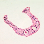 Micrograph of human parasite Schistosoma mansonii