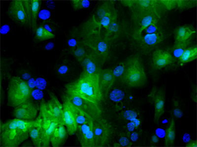 RSV infected infant cells