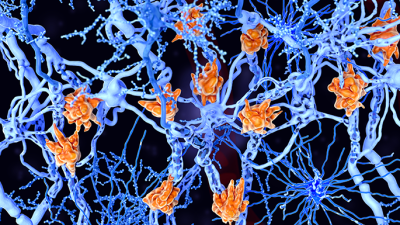 microglia cells damage the myelin sheath of neuron axons