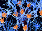 microglia cells damage the myelin sheath of neuron axons