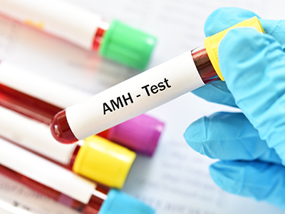 Blood sample tube for anti-Müllerian hormone