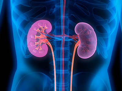 colored illustration of kidney x-ray
