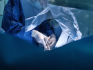 surgeon doing laparoscopic surgery