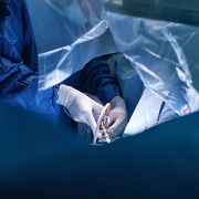 surgeon doing laparoscopic surgery