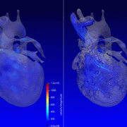 animation showing MRI cardiac imaging