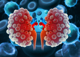 illustration of diseased kidneys