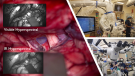 collage of hyperspectral imaging (sHSI) camera and brain surgery