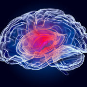 illustration of the brain with concussion