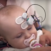 baby with brain monitor