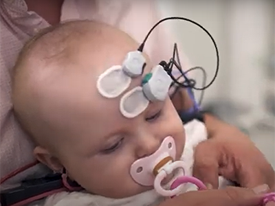 baby with brain monitor