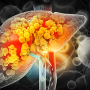 illustration of diseased liver