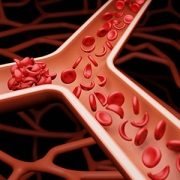 illustration of sickled blood cells