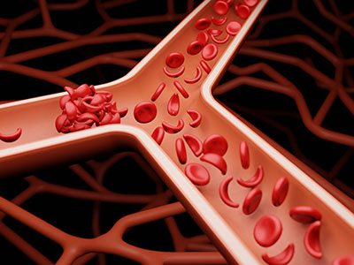 illustration of sickled blood cells
