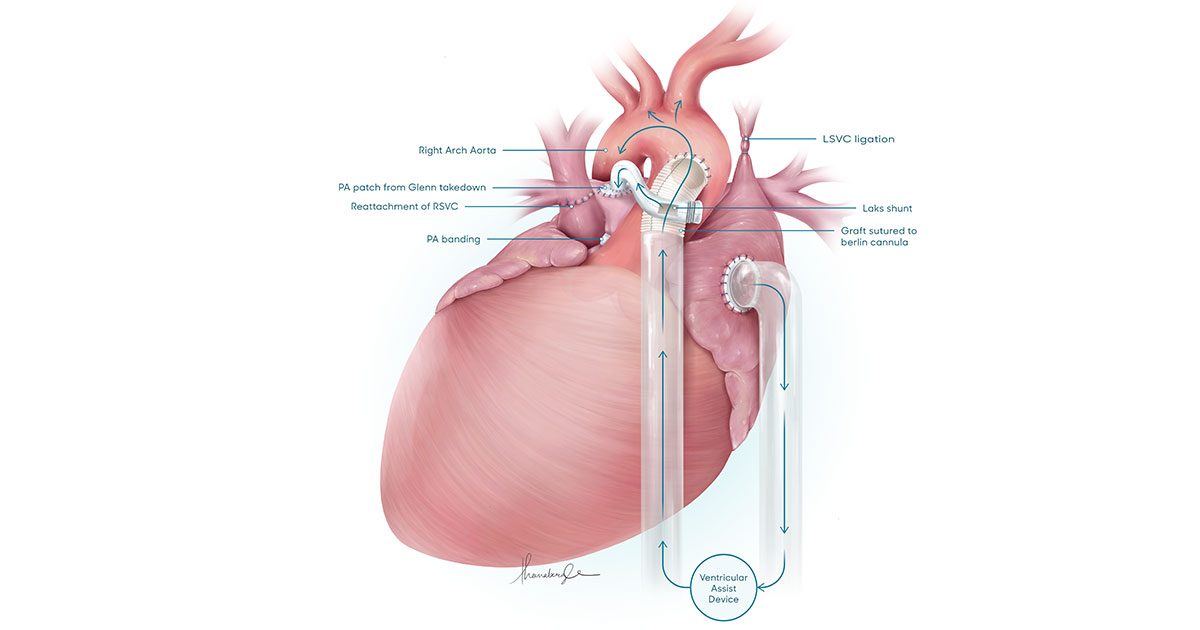 健康・医学 Surgery for congenital heart defects Comprehensive Surgical Management of Congenital Heart Disease