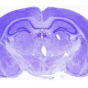 Histological section of a brain.