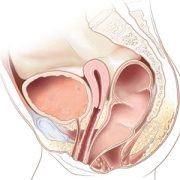 Rectoperineal fistula in a female