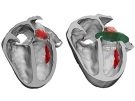 3D model for heart valve replacement planning