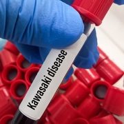 Blood sample for Kawasaki disease test,