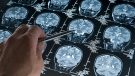 person studying brain scans