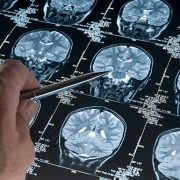 person studying brain scans