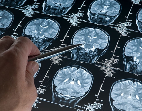 person studying brain scans