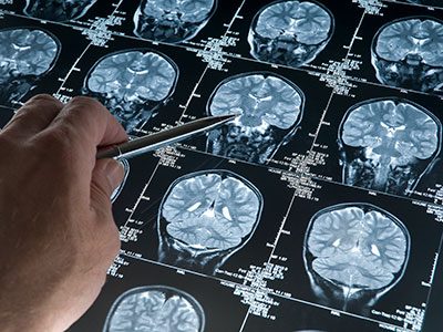 person studying brain scans