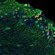 Histological image of the heart.