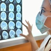 doctor looking at brain scan images