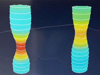 endoFLIP displayed esophagogastric junction