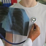 Doctor holding chest x-ray up to boy's chest