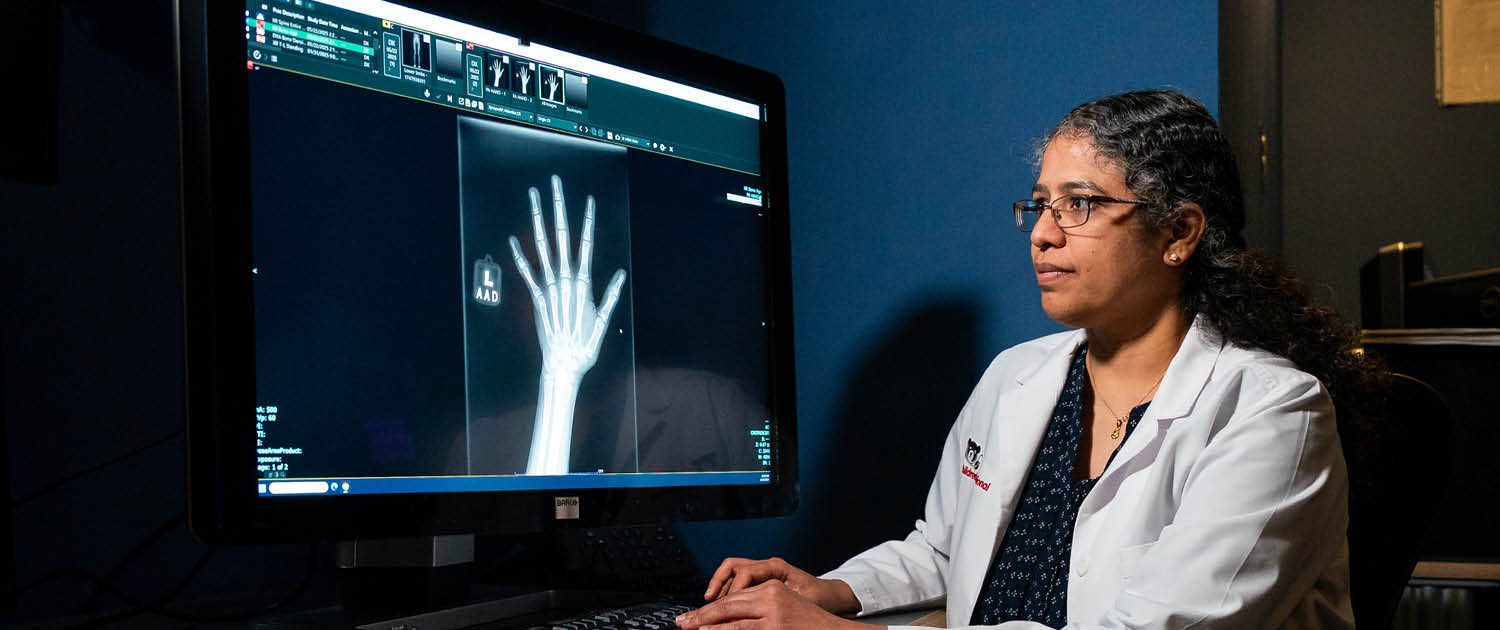 Doctor looking at an x-ray of a hand