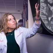 Doctor looking at a brain scan