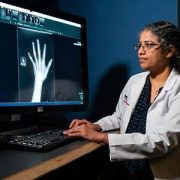 Doctor looking at an x-ray of a hand