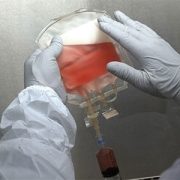 IV Bag with orange fluid