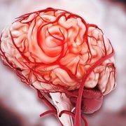 Medical illustration of a human brain highlighting blood vessels and blood flow