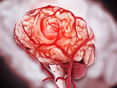 Medical illustration of a human brain highlighting blood vessels and blood flow