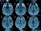 brain scans