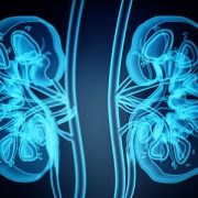 x-ray of kidneys